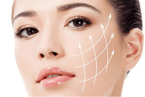 Căng chỉ collagen có an toàn không