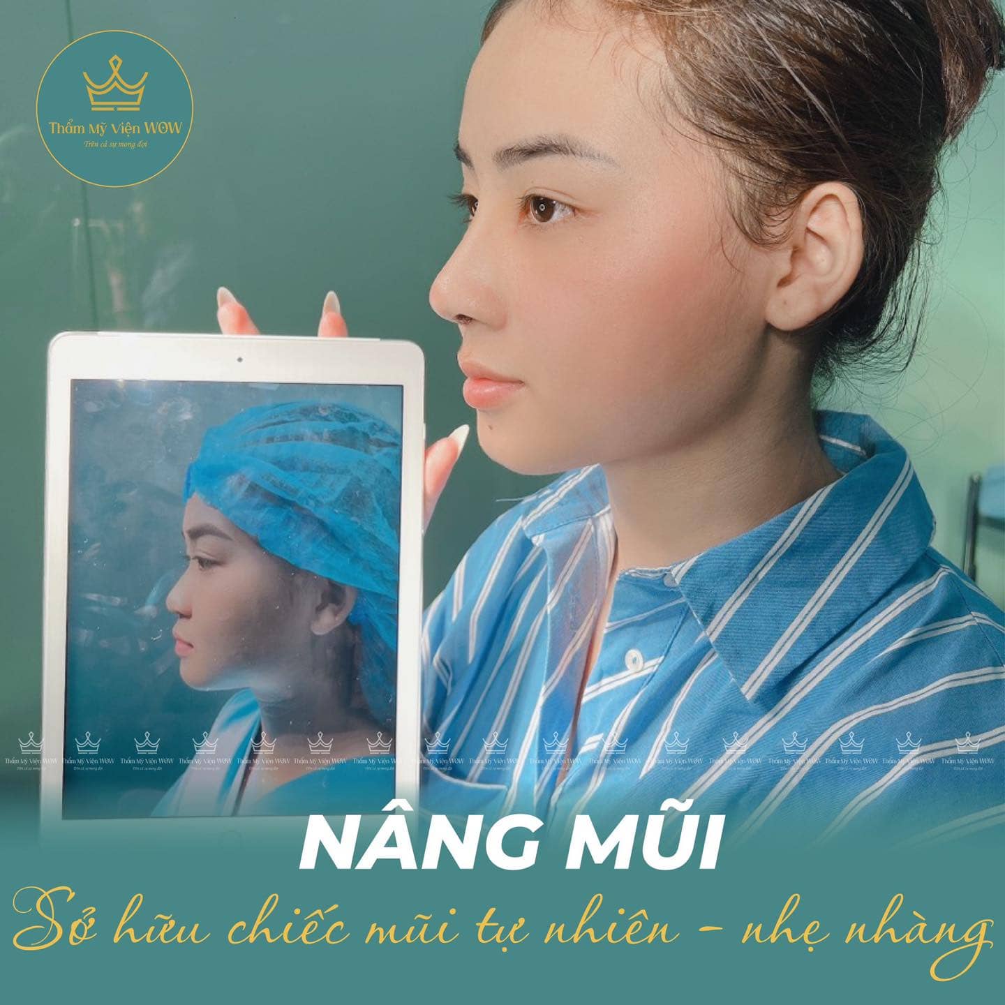 Nâng Mũi Có Đau Không?