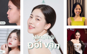 Nâng mũi đổi vận 2025