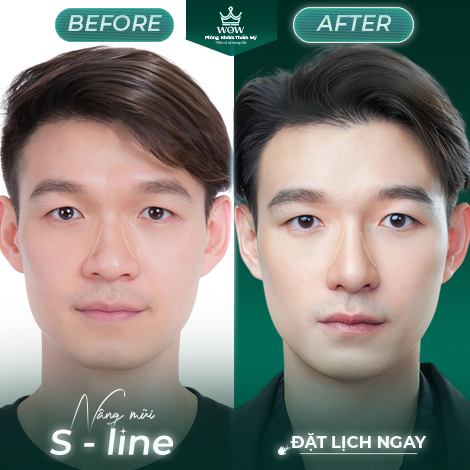 Hình ảnh dịch vụ thẩm mỹ tại Phòng khám WOW